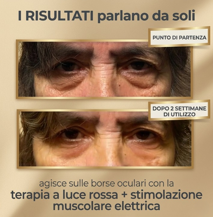 BACOMB™ 2 in 1 – Luce Rossa + EMS Anti-Borse
